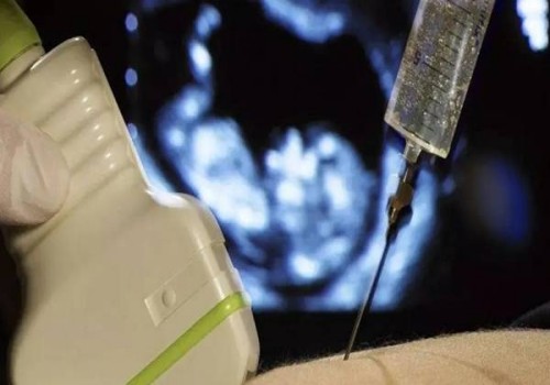 成都试管助孕公司：试管取卵不用担心会太疼，受不了可以进行麻醉