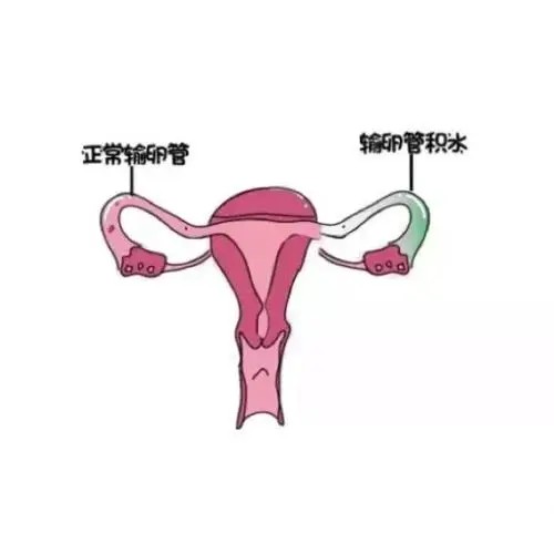 什么是脐带绕颈，采取这些措施尽量避免脐带绕颈