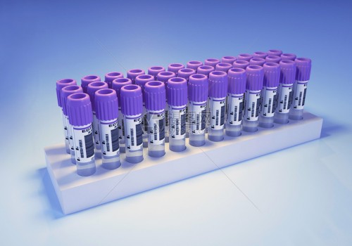 成都试管婴儿价格：移植16天有褐色血迹的原因，可能跟宫腔积液有关